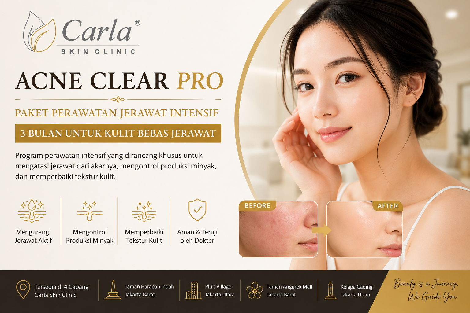 Acne Clear Pro: Paket Perawatan Jerawat Intensif 3 Bulan untuk Kulit Bebas Jerawat