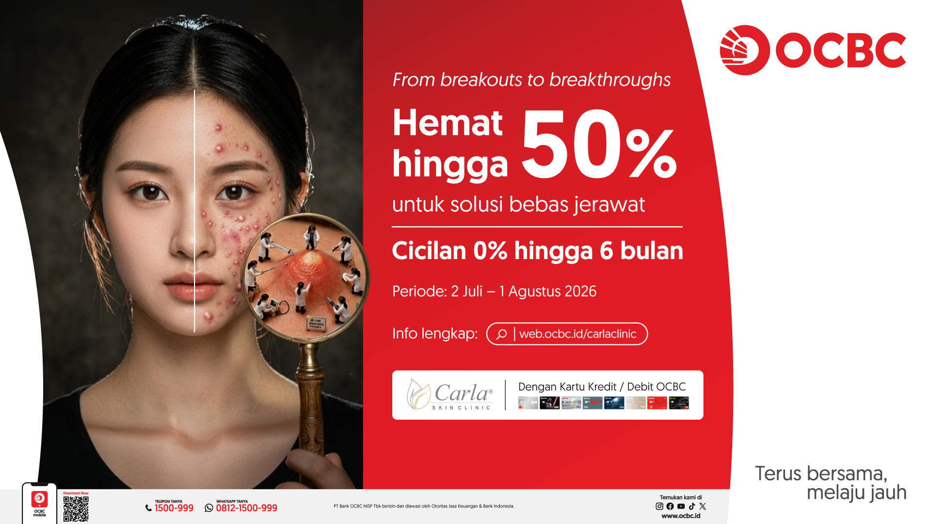 Bebas Jerawat Lebih Hemat dengan Promo OCBC